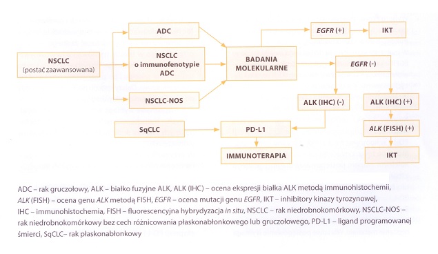 Algorytm postępowania diagnostycznego w zaawansowanej postaci raka niedrobnokomórkowego płuca