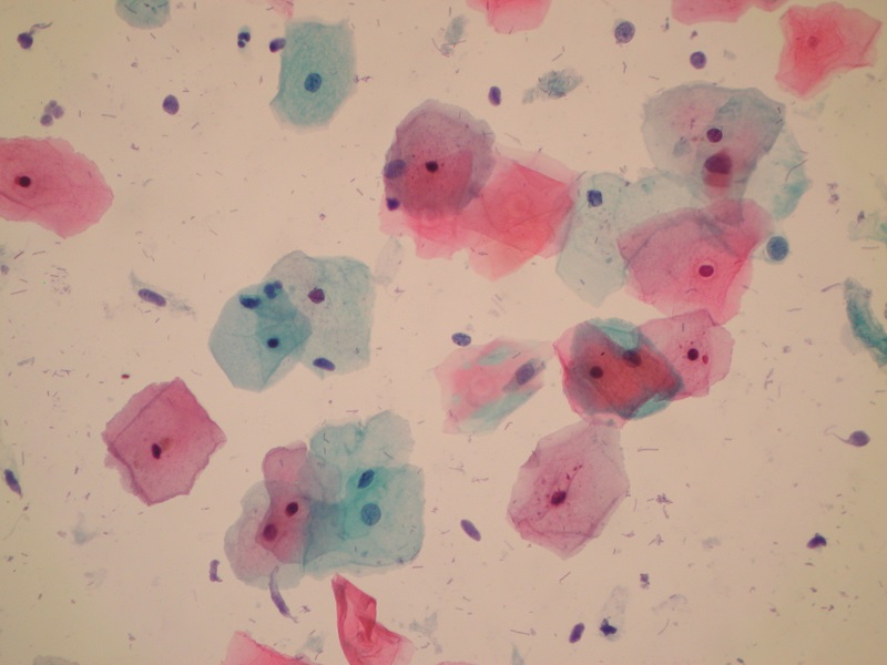 Cytologia szyjki macicy na podłożu płynnym LBC ClearPrep® – obraz mikroskopowy (obiektyw 40x)