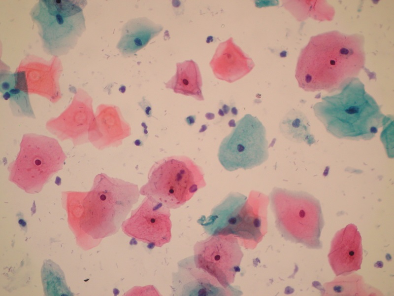 Cytologia szyjki macicy na podłożu płynnym LBC ClearPrep® – obraz mikroskopowy
