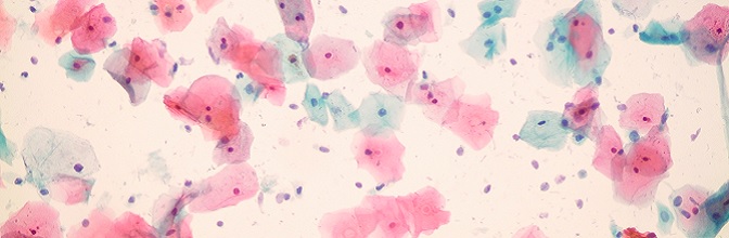 Cytologia szyjki macicy na podłożu płynnym LBC ClearPrep® – obraz mikroskopowy (obiektyw 20x)
