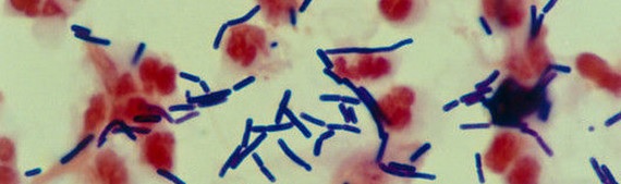 Lactobacillus spp.