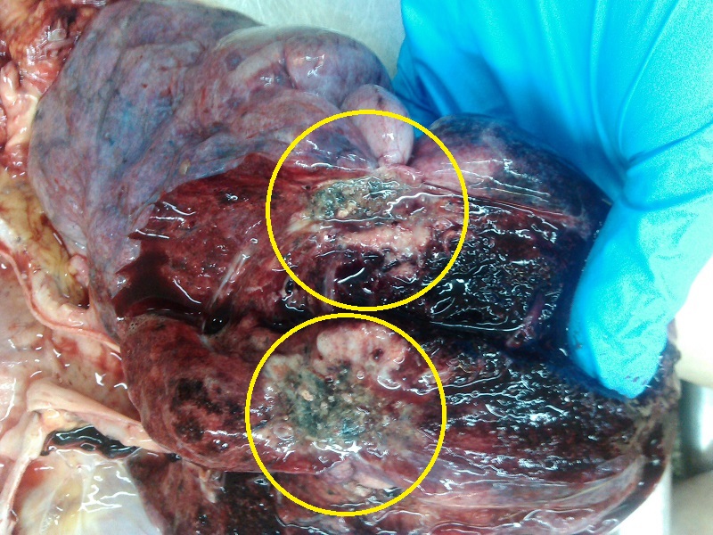 Rak płuca – obraz makroskopowy (sekcyjny)