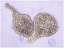 Obraz mikroskopowy Mycoplasma genitalium