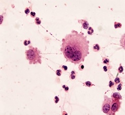 Komórki międzybłonka o zachowanej prawidłowej morfologii jądra i cytoplazmy