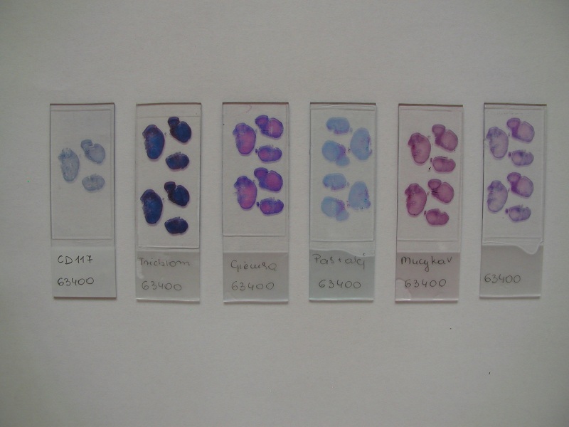 Barwienia stosowane w diagnostyce mikroskopowej polipa Vanek'a